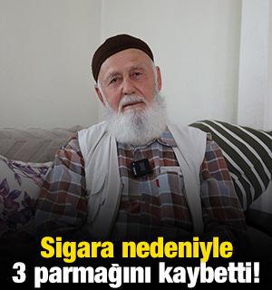 Sigara nedeniyle 3 parmağını kaybetti!