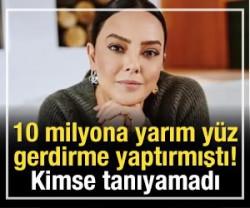10 milyona yarım y&uuml;z gerdirme yaptırmıştı! Kimse tanıyamadı