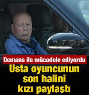 Demans hastalığı ile m&uuml;cadele ediyordu!