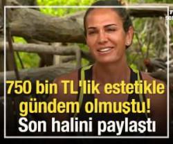 750 bin TL'lik estetikle g&uuml;ndem olmuştu! Son halini paylaştı