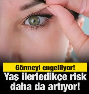 G&ouml;rmeyi engelliyor yaş ilerledik&ccedil;e risk artıyor! 